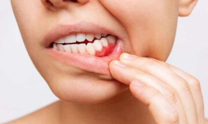 Habits That Harm Your Oral Health