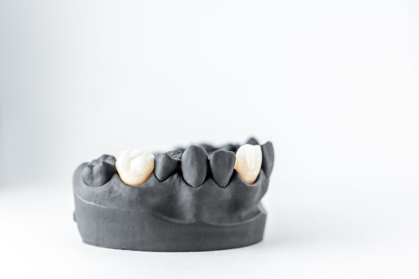 dental crowns in beaverton