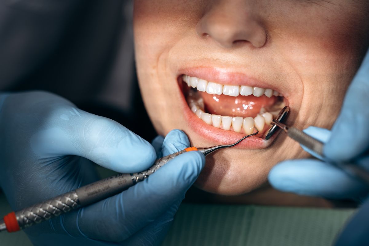 restorative dentistry beaverton