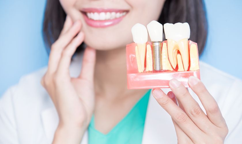 Dental Implant
