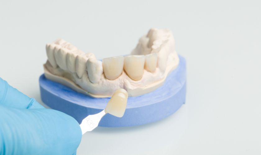 Unwrapping The Beauty Of Dental Crowns: A Christmas Special