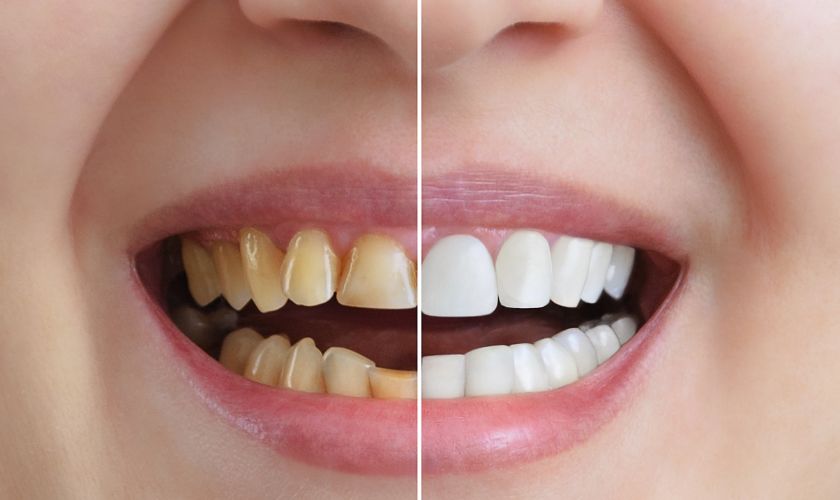 Cosmetic Dentistry Beaverton