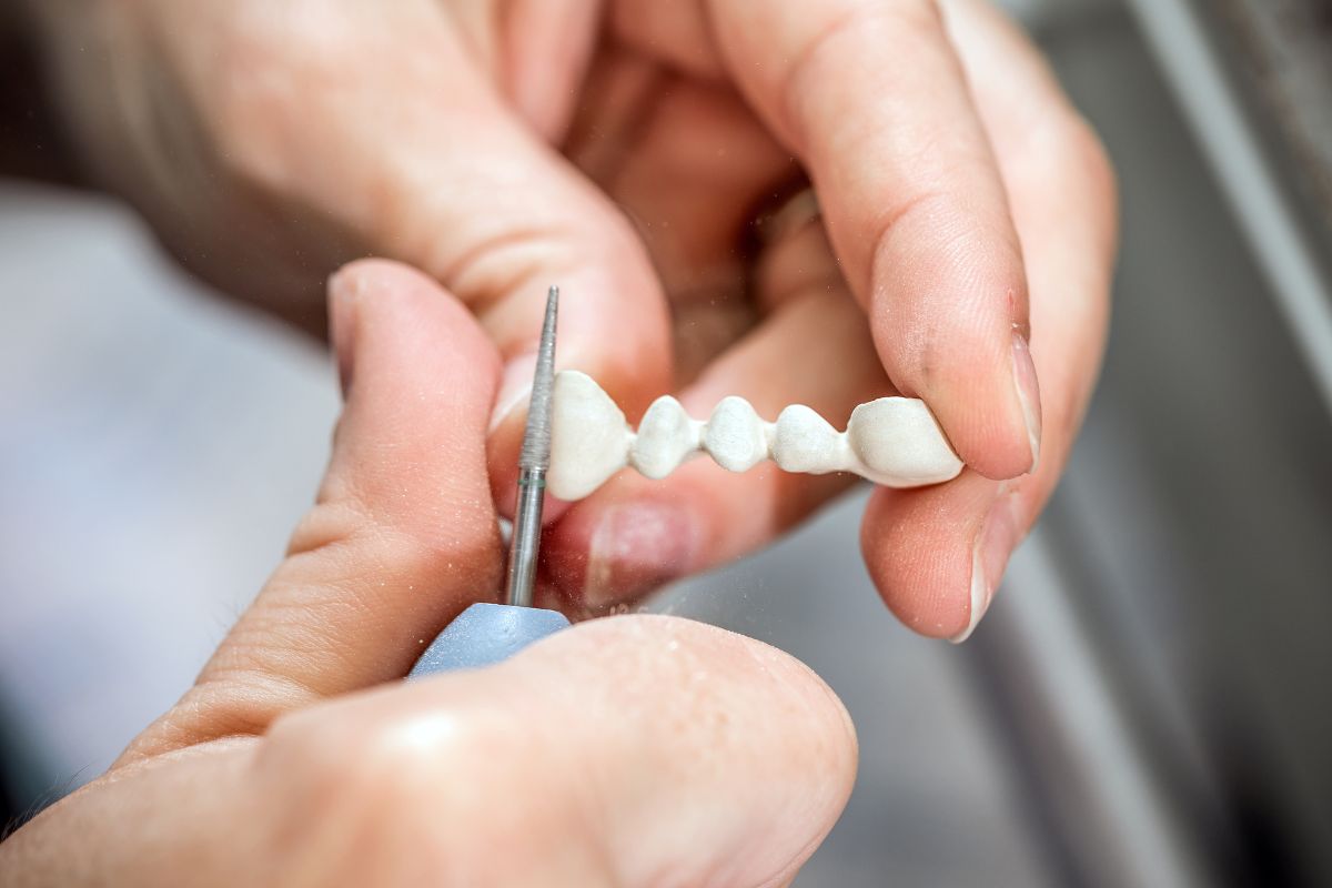 dental crowns in beaverton