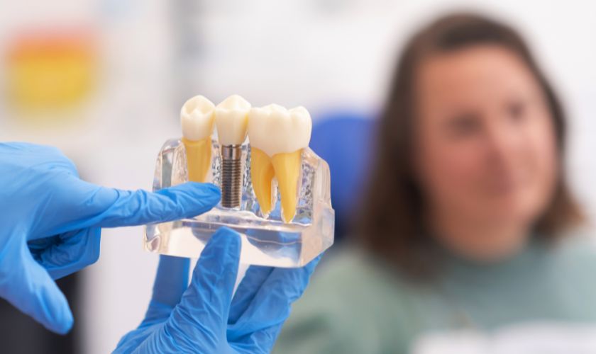 Dental Implants Beaverton