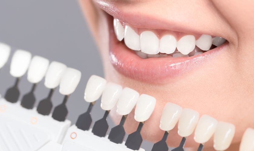 Featured image for “How Does Teeth Whitening Work?”