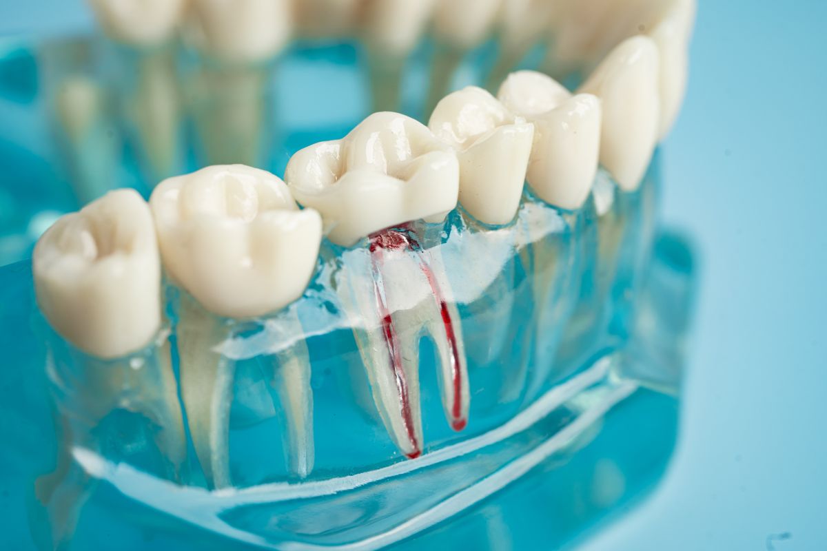 restorative dentistry beaverton