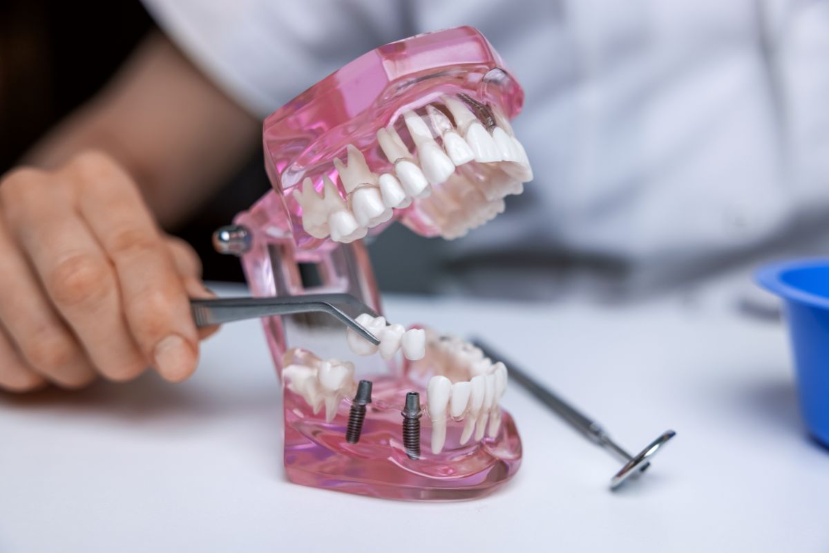 restorative dentistry beaverton