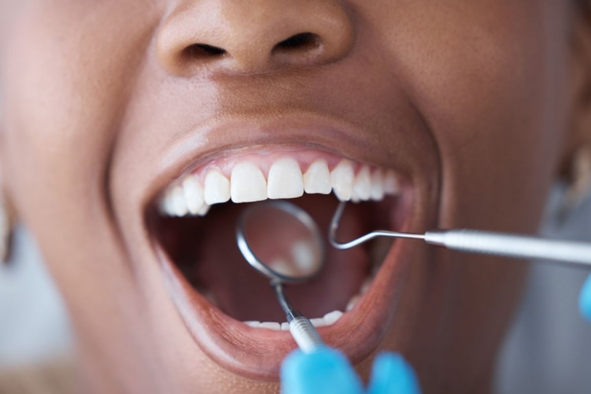 beaverton dentist