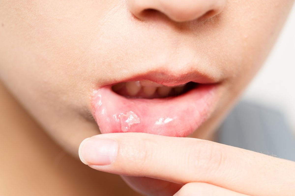 beaverton dentist