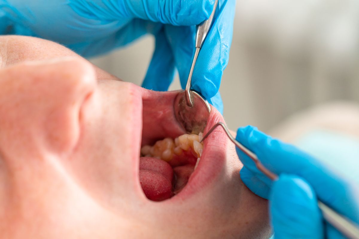 restorative dentistry beaverton