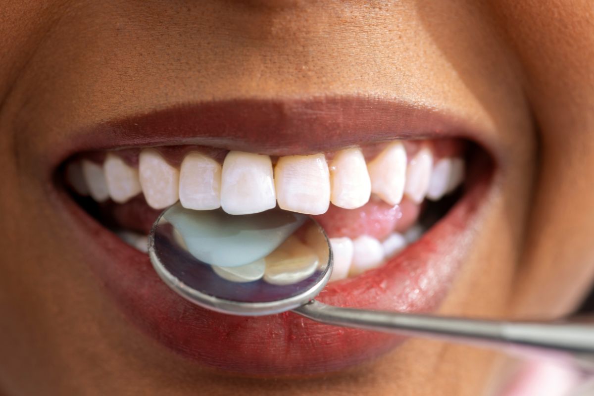 family dentist beaverton