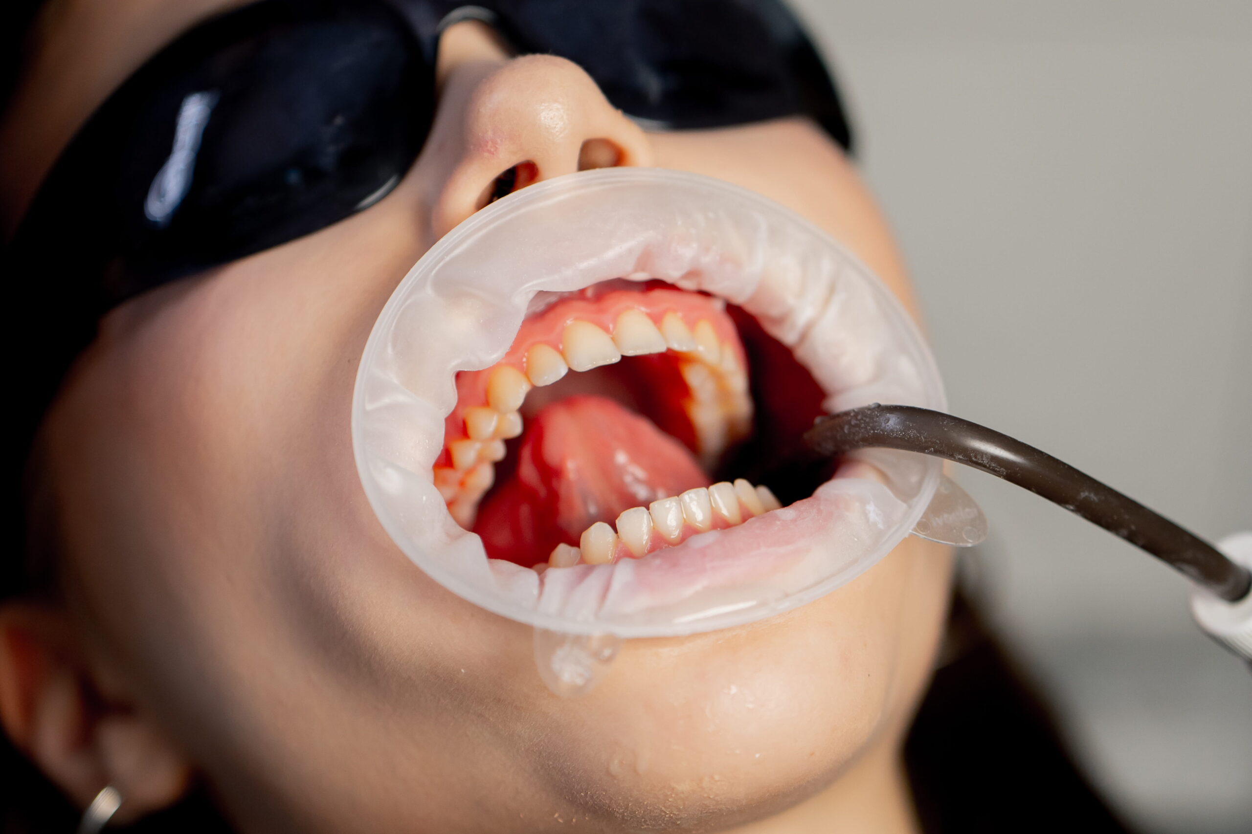 Featured image for “New Patient Dental Exam in Beaverton: What to Expect at Your First Visit”